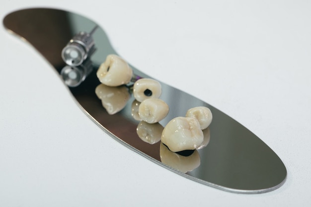 Dental Crowns