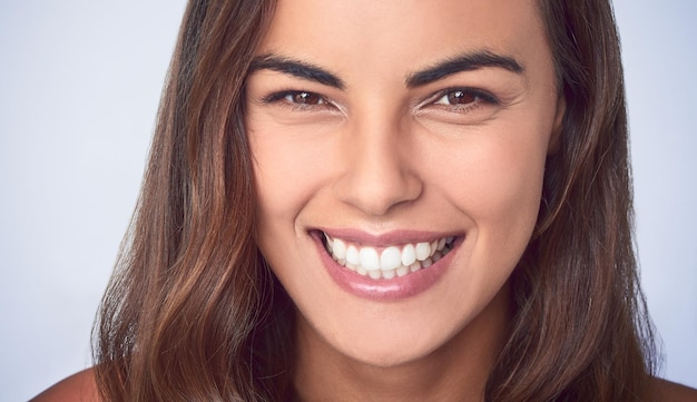 Teeth Whitening & Bleaching
